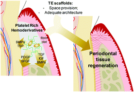 Graphical abstract: Periodontal tissue engineering: current strategies and the role of platelet rich hemoderivatives