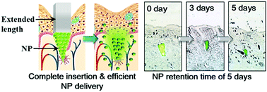 Graphical abstract: Efficient delivery of nanoparticles to deep skin layers using dissolvable microneedles with an extended-length design