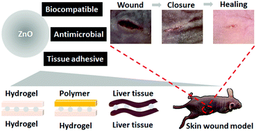 Graphical abstract: ZnO nanoparticles as an antimicrobial tissue adhesive for skin wound closure