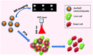 Graphical abstract: Facile synthesis of gold/gadolinium-doped carbon quantum dot nanocomposites for magnetic resonance imaging and photothermal ablation therapy