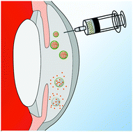 Graphical abstract: Gelatin-functionalized mesoporous silica nanoparticles with sustained release properties for intracameral pharmacotherapy of glaucoma