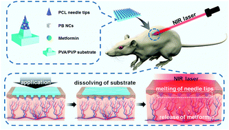 Graphical abstract: Near-infrared light triggered and separable microneedles for transdermal delivery of metformin in diabetic rats