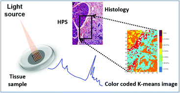 Graphical abstract: Characterization of inflammatory breast cancer: a vibrational microspectroscopy and imaging approach at the cellular and tissue level