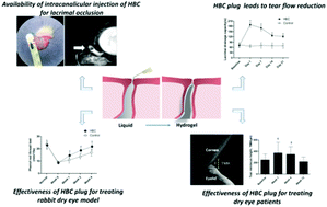 Graphical abstract: Treatment of dry eye by intracanalicular injection of a thermosensitive chitosan-based hydrogel: evaluation of biosafety and availability