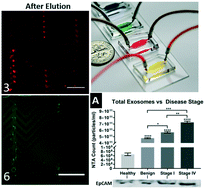 Graphical abstract: Microfluidic affinity separation chip for selective capture and release of label-free ovarian cancer exosomes