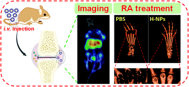 Graphical abstract: SPECT imaging and highly efficient therapy of rheumatoid arthritis based on hyperbranched semiconducting polymer nanoparticles