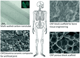 Graphical abstract: Carbon nanotube-based biomaterials for orthopaedic applications