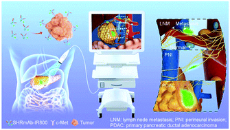 Graphical abstract: c-Met-targeted near-infrared fluorescent probe for real-time depiction and dissection of perineural invasion and lymph node metastasis lesions in pancreatic ductal adenocarcinoma xenograft models