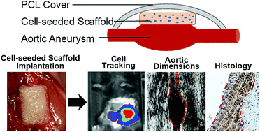 Graphical abstract: peri-Adventitial delivery of smooth muscle cells in porous collagen scaffolds for treatment of experimental abdominal aortic aneurysm
