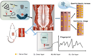 Graphical abstract: Label-free SERS ultrasensitive and universal detection of low back pain fingerprint based on SERS substrate