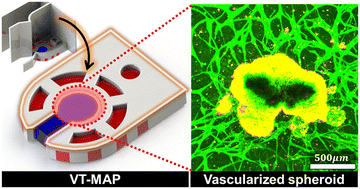 Graphical abstract: Vascularized tissue on mesh-assisted platform (VT-MAP): a novel approach for diverse organoid size culture and tailored cancer drug response analysis