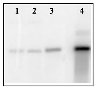 Southern hybridization of a putative bryostatin PKS cluster probe to DNA isolated from B. neritina. Lanes are: 1) total DNA, 2) bacterial-enriched fraction DNA, 3) Hoechst dye–CsCl gradient fractionated DNA, and 4) cosmid clone of the region.