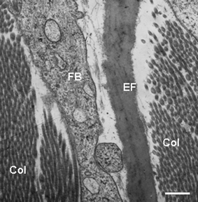 Transmission electron microscopy view of the dermis of normal human skin showing a portion of a fibroblast (FB), elastic fibre (EF) composed of the amorphous elastin with associated fibres, and obliquely sectioned collagen fibrils (Col). Scale bar = 0.25 µM