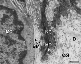 Transmission electron microscopy view of the lower epidermis of normal human skin showing the basement membrane zone separating the S. basale with keratinocytes (KC) and melanocytes (MC) and the collagen (Col)-rich dermis (D). Note the attachment of the KC to the basement membrane (BM)
							via hemi-desmosomes (HD). Scale bar = 0.6 µM