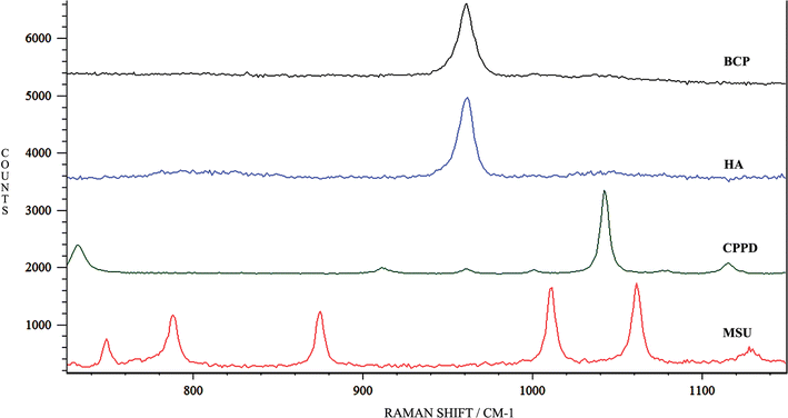 Raman reference spectra of synthetic BCP, HA, CPPD and MSU crystals.