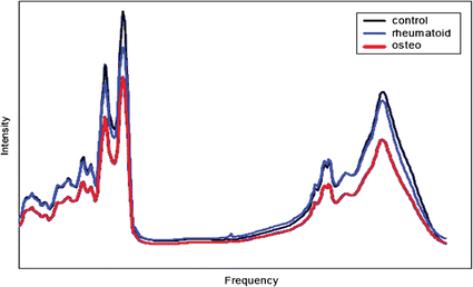 Caption typical infrared spectra of synovial joint fluid. Reproduced with permission from ref. 124. (Copyright 2004, IEEE.)