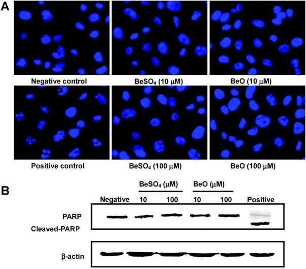 Cytotoxicity of cellular beryllium uptake on THP-1 macrophages. (A) The macrophages were treated with 10 μM or 100 μM of BeO or BeSO4, respectively, for 48 h, fixed and stained with DAPI. The nuclei were then photographed under fluorescence using a blue filter (400× magnification). (B) Western blot analysis of PARP from the THP-1 differentiated macrophages treated with 10 μM or 100 μM of BeO or BeSO4, respectively, for 48 h. THP-1 macrophages that were untreated were the negative control. Doxycycline treated THP-1 macrophages were the positive control. All DAPI-stained images and Western blots are representative of three independent experiments.