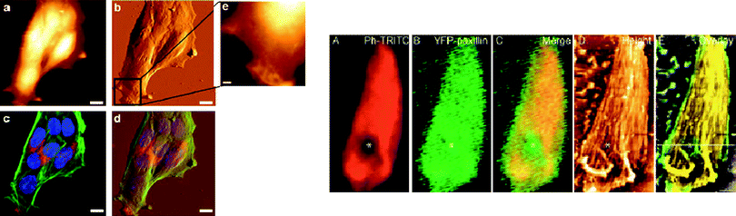 Left: Combined AFM and confocal imaging of mouse embryonic fibroblast. (a) and (b) are AFM topography and deflection images; (c) confocal imaging of cells exhibiting fluorescently labelled organelles (blue, nuclei; green: actin filaments; red: clathrin); (d) overlay of confocal and AFM imaging (reproduced from ref. 27 with kind permission from Springer Science + Business Media). Right: High-resolution imaging of focal adhesion points of de-roofed cells, with actin labelled in red (A) and YFP-paxillin (B, green). The partial disruption of the architecture is shown in the AFM (D) and f-actin-labelled confocal image, but not in the paxillin image, indicating that paxillin localization is more proximal to the focal adhesion while f-actin is localized beyond in the membrane-distal half. (From ref. 12, reproduced with permission of the Journal of Cell Science).