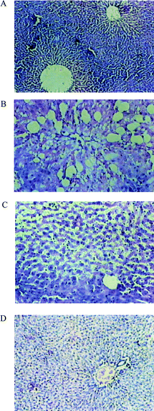 
          Photomicrographs of liver sections of rats stained with haematoxylin and eosin (200X). A: Normal rat showing a central vein surrounded by normal hepatocytes. B: CCl4-treated rats showing a dilated central vein and hepatocytes with fatty change and ballooning degeneration. C: CCl4 + S. laxissima (100 mg kg−1 body weight) treated rats showing the central vein and normal hepatocytes with occasional hepatocytes showing fatty change and ballooning degeneration. D: Liver section of rats treated with CCl4 and silymarin showing minimal inflammatory cellular infiltration, and near-normal liver architecture.
