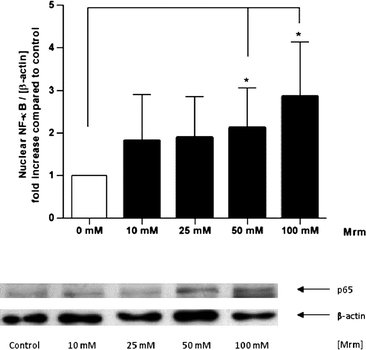 Nuclear translocation of NF-κB induced by roasting products in human gut tissue ex vivo. The tissue samples were stimulated with MRM (10–100 mM) in modified PBS for 2 h. The intensity of the p65 signal (NF-κB subunit) was related to the loading control β-actin and expressed as n-fold increase compared to PBS treated control. Data are mean ± SD (n = 5–7); * p < 0.05, ** p < 0.01, *** p < 0.001. Representative Western blot of p65 and β-actin in human gut tissue.