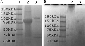 
            SDS-PAGE analysis of enzymatic degradation of tELP (A) and tELP-g-poly(OEGMA) (B). In panel A, lane 1: protein marker; lane 2: tELP; lane 3: tELP after digestion for 1 h. In panel B, lane 1: protein marker; lane 2: tELP-g-poly(OEGMA); lane 3: tELP-g-poly(OEGMA) after digestion for 1 h.