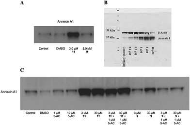 Induction of annexin A1 by PABA HDAC inhibitors9 and 11. Panel A: Induction of annexin A1 in MCF7 human breast tumor cells by 9 and 11 at 3.0 μM; Panel B: Dose dependence of annexin A1 induction by compound 11 (0.3 to 3.0 μM) in MCF7cells; Panel C: Effects of compounds 9 or 11 on annexin A1 alone or in combination with 5-AC.