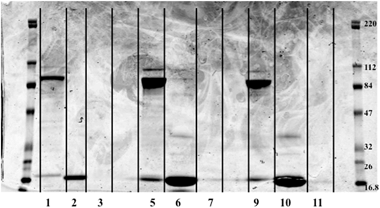 Image of 1-D gel. Image was obtained with an Odyssey Infra-red Imaging System from LI-COR, Lincoln Ne., USA. Far lanes contain molecular weight ladders while sample was loaded in the middle lanes. Lane 1 – CSF control Fraction #1, L2 – CSF control #2, L3 – CSF control #3, L5 – CSF C#1, L6 – CSF C#2, L7 – CSF C #3, L9 – CSF V #1, L10 – CSF V #2, L11 – CSF V #3, Lanes 4, 8, 12 – Blank. Fraction 3 for each sample had no stained protein bands present. Molecular weight of standards is in kDa.