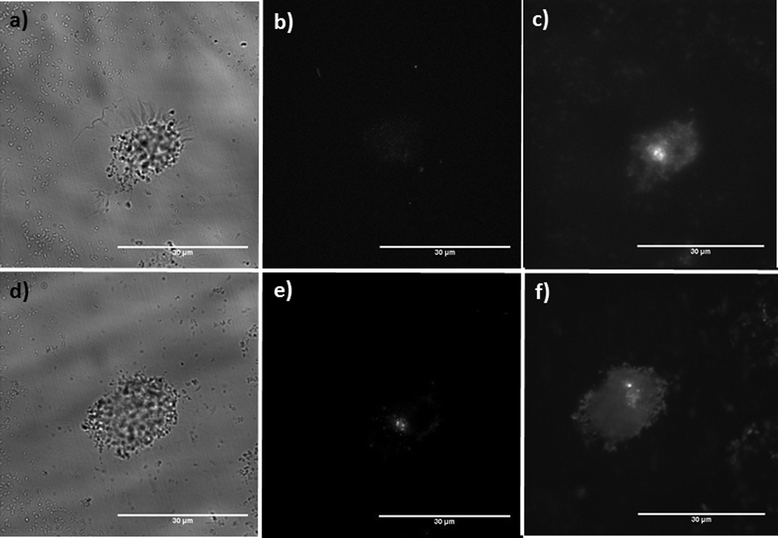 Visualisation of COS7 cells using citric acid-coated (Y0.96Eu0.04)OOH and (Y0.96Eu0.04)2O3 nanoparticles. Data generated from (Y0.96Eu0.04)OOH nanoparticles: (a) A bright-field image of a cell incubated with (Y0.96Eu0.04)OOH NPs, (b) shows cellular autofluorescence measured at 470 nm excitation/540 nm emission. (c) Down converted luminescence following 470 nm excitation/620 nm emission shows uptake. Data generated for the (Y0.96Eu0.04)2O3 nanoparticles is presented in (d–f): (d) A bright-field image of a cell incubated with NPs, (e) cellular autofluorescence measured at 470 nm excitation/540 nm emission, (f) luminescence following 470 nm excitation/620 nm emission shows uptake (scale bar, 30 μm).