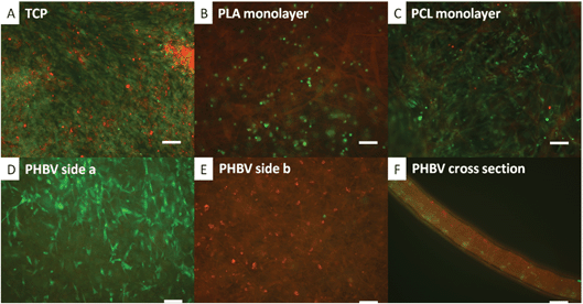 Co-culture of CellTracker™ labelled fibroblasts (green) and hESMPs (red) on a range of scaffolds. In A hESMPs were seeded on day 1 (red) followed by an equal ratio of fibroblasts on day 2 (green) and cultured for 7 days on TCP. In B–F hESMPs were seeded on one side of the scaffold on day 1, and then fibroblasts on the other side on day 2 and these were then cultured for a further 7 days. The scaffolds used were PLA in B, PCL in C and PHBV in D, E and F. In A, B and C there is a clear mixture of red and green cells. In D and E however cells remain segregated. All fibroblasts (green) are shown on the surface shown in D and all hESMPs (red) are seen on the opposite side (E). F shows a cross section of the PHBV scaffold with clear separation of the hESMPs and fibroblasts. Scale bars 0.1 mm.