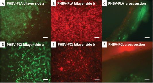 Co-culture of CellTracker™ labelled fibroblasts (green) and hESMPs (red) on bilayer membranes of either PHBV–PLA or PHBV–PCL. hESMPs were seeded on day 1 (red) onto the PHBV face of each bilayer. Fibroblasts were seeded on either the PLA or PCL face of the bilayer on day 2 (green) and then cultured for a further 7 days. In A fibroblasts (green) are confined to the PLA face after 7 days with no sign of hESMPs (red). On the opposite face (B, PHBV), hESMPs (red) are also present once again with no fibroblasts. A cross section of the PHBV–PLA membrane is shown in C showing each cell type on its respective side after 7 days of culture. In D and E, fibroblasts (green) and hESMPs (red) are shown on the PCL and PHBV faces respectively and there is no mixing across these faces. F shows a cross section of the PHBV–PCL membrane and clearly shows each cell type still confined to their respective faces after 7 days of culture. All scale bars are equal to 0.1 mm.
