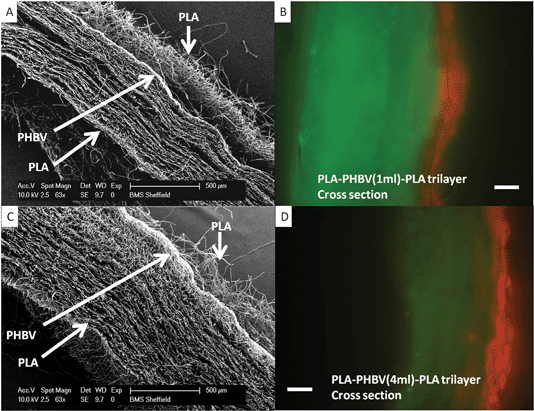 SEM and fluorescence microscopy of PLA–PHBV–PLA trilayers with reduced PHBV layer thickness. Panels A and C shows SEM cross sections of trilayers made using 1 ml and 4 ml of PHBV respectively (5% and 25% of original volume used in Fig. 4, 5 and 7. Microfibrous PLA is present on the top and bottom of each scaffold, with a dense nanofibrous PHBV slither through the middle of each. Panels B and D show fluorescence microscopy of cross sections with fibroblasts (green) cultured on one face and keratinocytes (red) cultured on the opposite face with separation maintained after a week (demonstrated by no ‘bleed though’ of the colours to opposite faces).