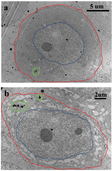 TEM images of MCF-7 cells after they were cultured with DOX–HMNPs for 24 hours. The red line corresponds to the cell membrane, the blue line corresponds to the nuclear membrane. The distribution of HMNPs in the cytoplasm is marked with a green line. The nanocapsules mainly localized in the cytoplasm, small nanocapsules were found in cell nucleus.