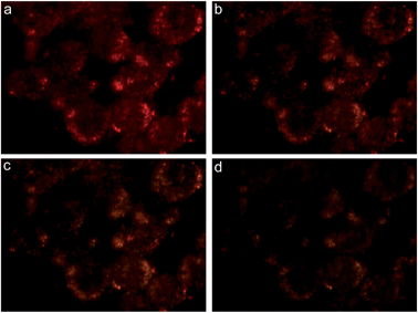 Dark-field images of live MDA-MB-435 cells incubated with folate-targeted vesicles exposed to light for 0 min (a), 5 min (b), 10 min (c) and 15 min (d).