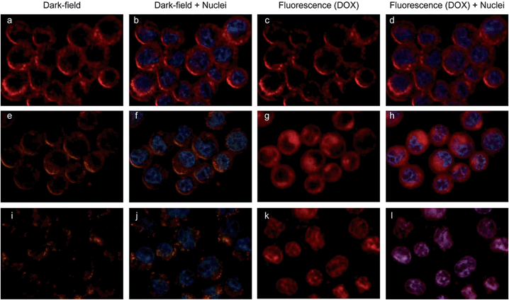 Uptake and dissociation of folate-conjugated vesicles in MDA-MB-435 breast cancer cells and the DOX release revealed by dual-modality imaging. Dark field (a, e and i), fluorescence (c, g and k), and the overlaid images (b, d, f, h, j and l) of live MDA-MB-435 cells labeled with DOX-loaded vesicles without light irradiation (a–d), exposed to light for 15 min and post-incubation for 20 min (e–h) and 60 min (i–l) after the photo-irradiation. DOX has a red fluorescence, and cell nuclei were stained with Hoechst 3342 exhibiting blue fluorescence.