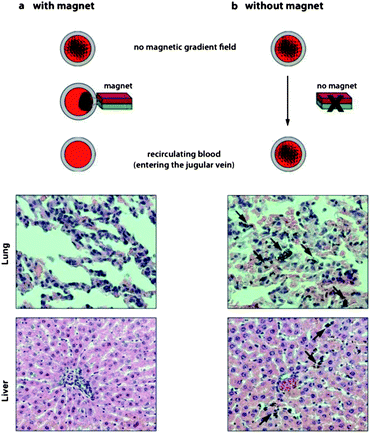 Histological examination of lung and liver from rats undergoing extracorporeal blood purification with or without magnetic separation of the nanomagnets before recirculation (H&E staining). If nanomagnets are separated prior to re-entry into the body, histological images show no accumulation of nanomagnets in tissue (a). If nanomagnets are not separated before re-entry into the body (no magnet), nanomagnets are detected in both lung and liver tissues (black arrows) (b).