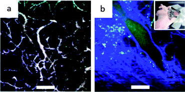 TPL imaging through a dorsal window chamber (inset) on a nude mouse. (a) With nanostars, (b) without nanostars. The blue and green colors were from the collagen and blood. Scale bar 100 μm. Reproduced with permission from ref. 106.