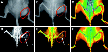 Real-time in vivo X-ray images after intravenous injection of AuNR–SiO2–FA in nude mice at different time points. (A) The photograph of the tumor tissue; (B) the X-ray image at 0 h; (C) the X-ray image at 0 h (in color); (D) the X-ray image at 12 h, (E) the X-ray image at 12 h (in color); (F) the X-ray image at 24 h (in color). Reproduced with permission from ref. 169.