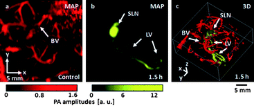 
            In vivo photoacoustic (PA) mapping of rat lymphatic systems, enhanced using AuNSt. (a) Control PA image acquired before AuNSt injection, displaying only blood vessels (BV). (b) PA difference image acquired post-injection (t¼ 1.5 h), revealing the sentinel lymph node (SLN) and lymphatic vessels (LV). A separate intensity scale (yellow) was applied to the lymphatic system after subtraction of image (a). (c) 3D rendering of (b). Reproduced from ref. 122.