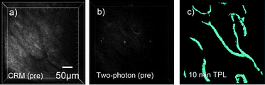 Representative two-photon microscopy images of intravenously delivered AuNR in a hamster model with accompanying confocal reflectance image. (a) Confocal reflectance image of tissue showing location of blood vessels which appear dark against the surrounding tissue. (b) High power (20 mW) two photon image of the same vascular region prior to intravenous injection of AuNR. (c) Two photon image using low incident power (1 mW) following intravenous injection of AuNR showing blood vessels in the tissue. Reproduced with permission from ref. 158.