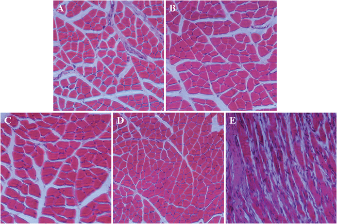 Tissue responses after intramuscular injections of mPEG113-S2-PZLL18 micelle2 (A) and mPEG113-S2-PZLL35 micelle2 (B) as compared with that without (C), and with PBS (D) and PEI25k (E) injections. Tissue sections were analyzed by H&E staining after 7 days following injection.