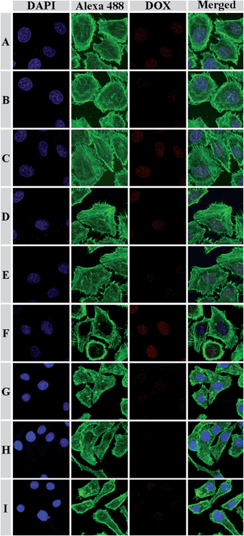 Representative CLSM images of HeLa cells incubated with DOX-loaded mPEG113-S2-PZLL18 micelles (A, B and C) and mPEG113-S2-PZLL35 micelles (D, E and F), and HepG2 cells incubated with DOX-loaded mPEG113-S2-PZLL18 micelles (G, H and I) for 2 h: (A, D and G) cells without pretreatment; (B, E and H) cells pretreated with 0.5 mM BSO; (C, F and I) cells pretreated with 10.0 mM GSH-OEt. The cell nuclei and cytoskeleton of the cells were stained with DAPI (blue) and Alexa 488 (green), respectively.