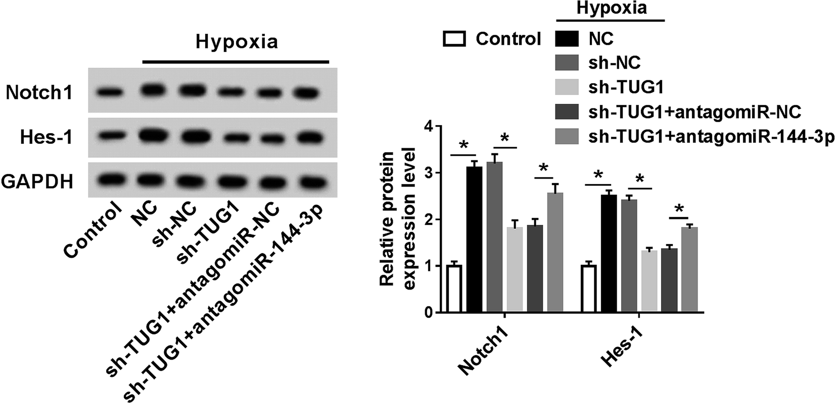 retracted article: knockdown of tug1 aggravates hypoxia-induced