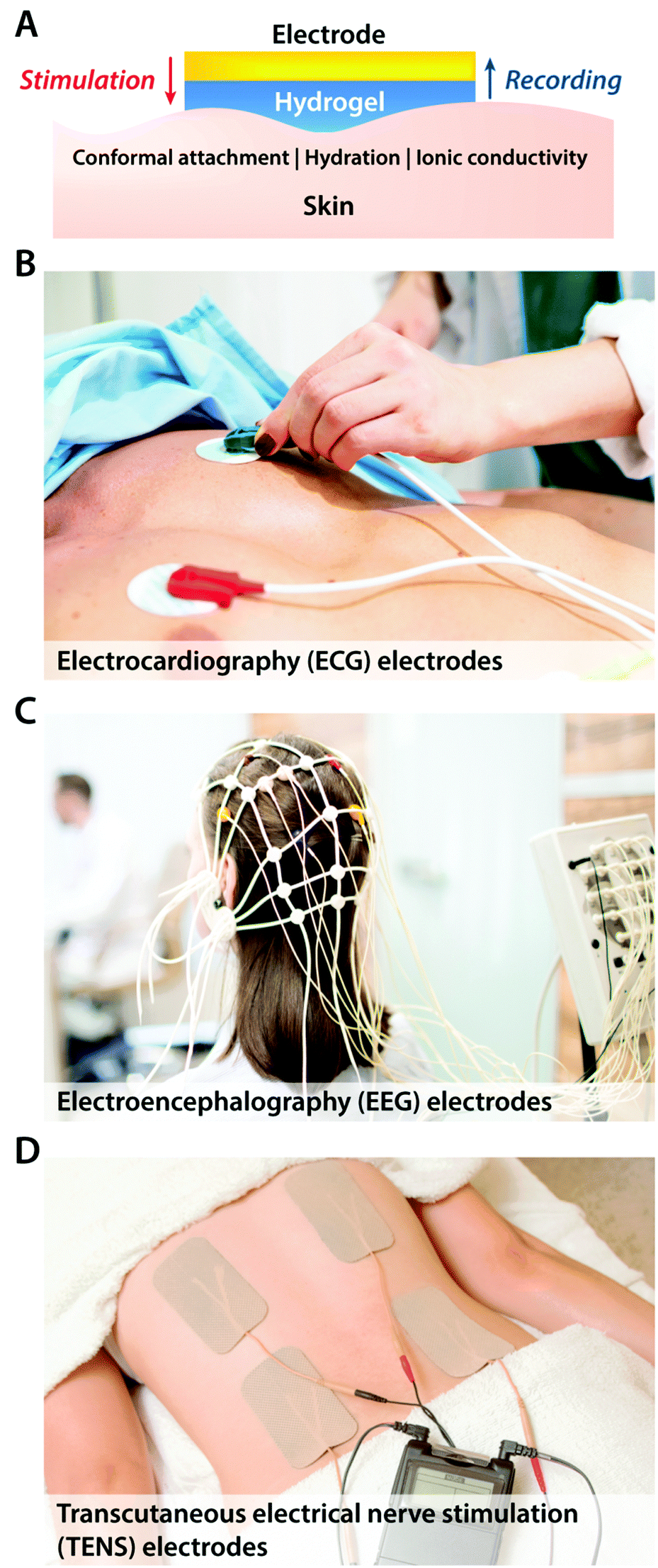 Hydrogel Bioelectronics Chemical Society Reviews RSC Publishing DOI