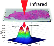 Graphical abstract: Fundamental developments in infrared spectroscopic imaging for biomedical applications