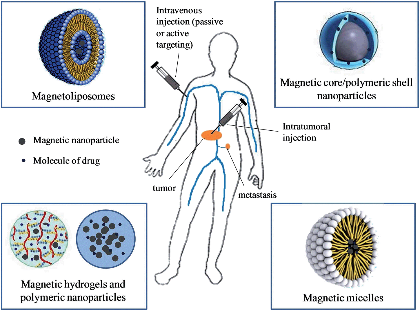 Hyperthermia and radiation breast cancer