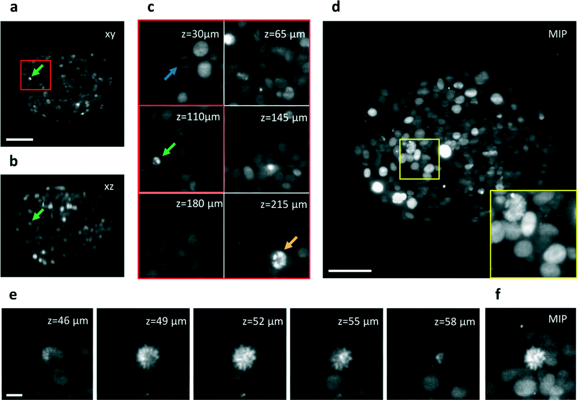 联想tp00084a配置,联想tp00083a配置 selective plane illumination microscopy on a chip