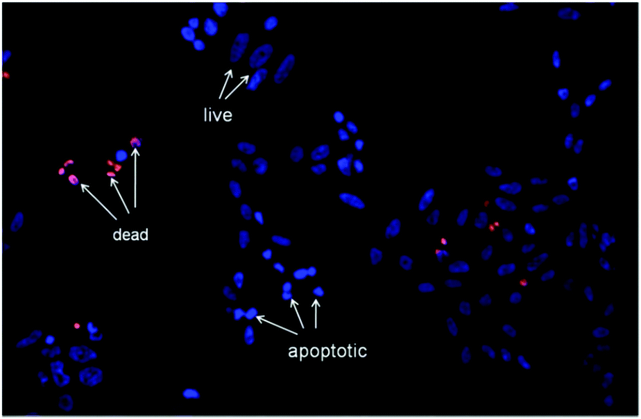 Cellular internalisation, bioimaging and dark and photodynamic