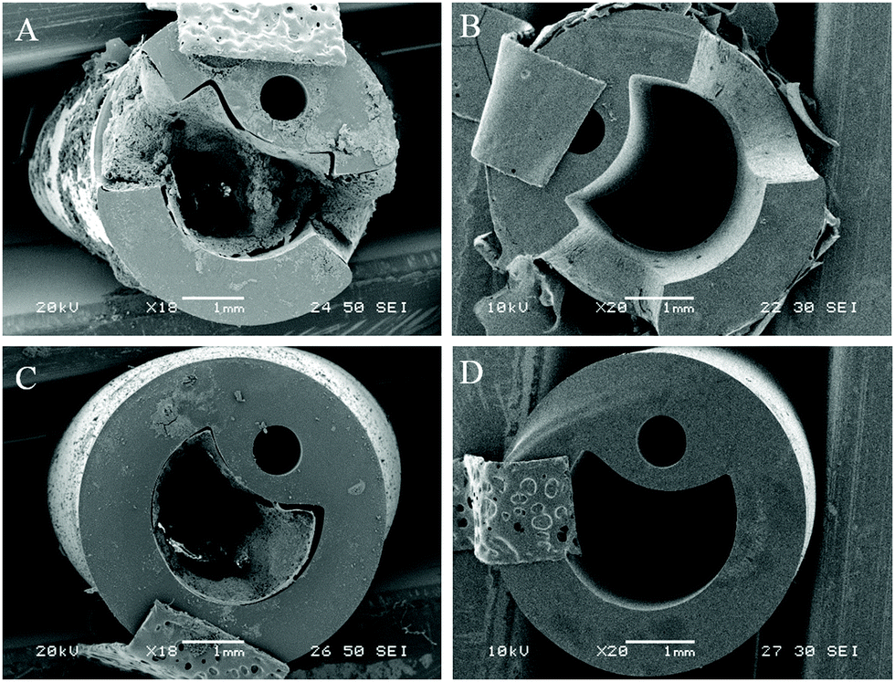 Prevention of encrustation and blockage of urinary catheters by Proteus