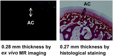 Design, synthesis, and preliminary ex vivo and in vivo evaluation of cationic magnetic resonance contrast agent for rabbit articular cartilage imaging