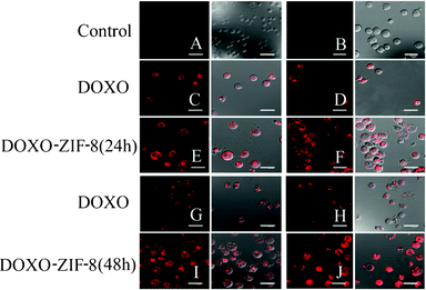 Confocal microscopy of HL-60 cells incubated in the absence (A) or presence of ZIF8 (B); IC50 (C) and 2 × IC50 (D) of DOXO; IC50 (E) and 2 × IC50 (F) of DOXO–ZIF-8 for 24 h; IC50 (G) and 2 × IC50 (H) of DOXO; IC50 (I) and 2 × IC50 (J) of DOXO–ZIF-8 for 48 h. The left column represents the fluorescence of the red channel and the right column represents the merging of the red channel and the differential interference contrast image.